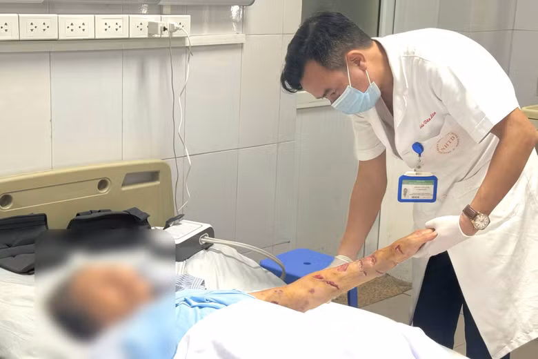 Hai người cao tuổi bị chó nhà cắn, bác sĩ cảnh báo